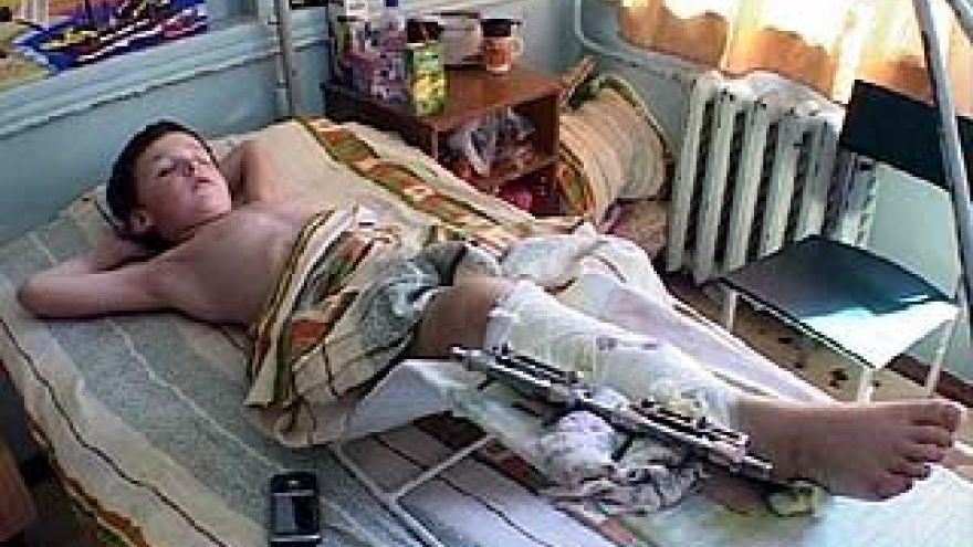 Пострадавшим ребёнком занимаются врачи, а упавшими деревьями - прокуратура