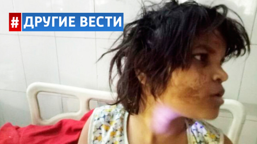 В природном заповеднике на севере Индии нашли «девочку-Маугли»