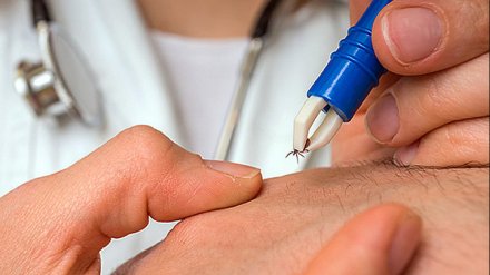 В Воронежской области после укусов клещей болезнью Лайма заразились 33 человека