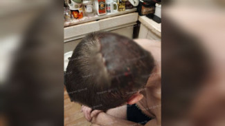 Врачи оценили состояние пострадавшего после нападения подростков воронежца