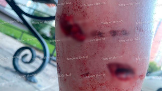 В Воронеже собаки напали на двух девушек на Олимпийском бульваре