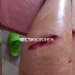 Бездомная собака напала на женщину и разорвала ей ногу в центре Воронежа