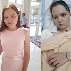 «Говорит глазами». Муж вышедшей из комы 22-летней жертвы ДТП просит воронежцев о помощи