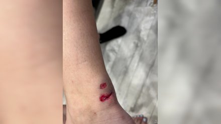 В Павловске подросток на электросамокате рассёк девушке ногу и скрылся