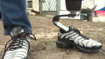 «Стопа гепарда». Воронежскому ветерану СВО впервые в регионе изготовили протез для бега