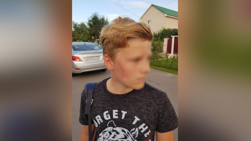 «От ударов упал на колени». Под Воронежем бывший полицейский избил 12-летнего мальчика