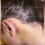 17-летнюю девушку выписали из больницы после ЧП на картинге в Воронеже