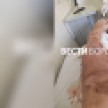 Впал в кому, остался без ноги. Жена рассказала о травмировании воронежца на работе в Лисках
