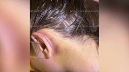 Полиция начала проверку после ЧП с пострадавшей в воронежском картинге девочкой 