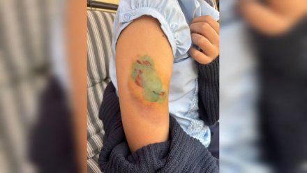 В Воронеже доберман набросился на 10-летнюю девочку