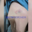 В Воронеже сбежавший от родителей инвалид ударил троих детей на улице