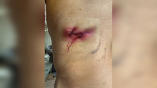 Раненый в поножовщине у «Бархата» воронежец попросил отправить нападавших в СИЗО