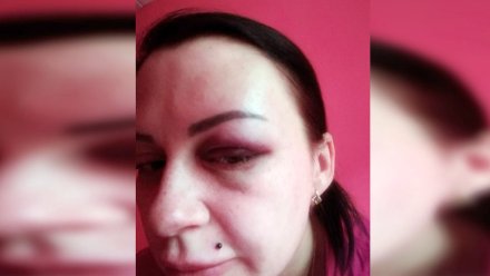 Госпитализированная с разрывом печени жительница Воронежа рассказала о причинах конфликта с мужем