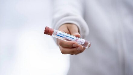 Коронавирус диагностировали ещё у 91 жителя области