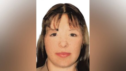 В Воронежской области объявили поиски 35-летней женщины со шрамом