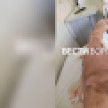 Завод в Лисках оштрафовали на 305 тысяч после ЧП с лишившимся ноги рабочим