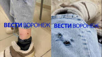 В Воронеже так и не смогли поймать искусавших девушку у института МВД собак
