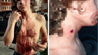 Поводом для нападения азербайджанца на 15-летнего воронежца стал украденный арбуз