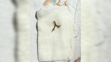 В Воронеже годовалая девочка начала задыхаться из-за застрявшей в горле виноградной ветки