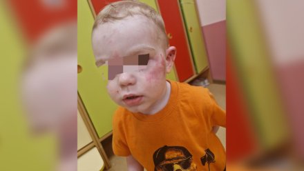 Следователи начали проверку после избиения 2-летнего мальчика в детском саду под Воронежем