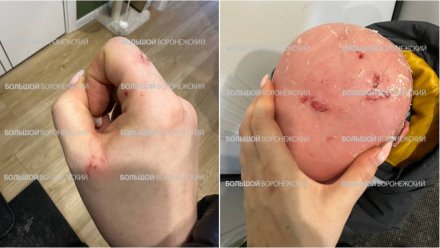 На ребёнка-инвалида упали сосульки у ТЦ «Европа» в Воронеже