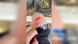 В воронежском ЖК подростка покусала сорвавшаяся с поводка такса