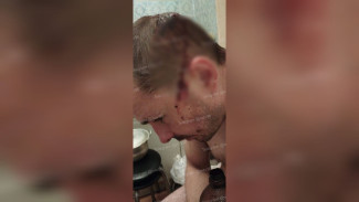 В Воронеже трое подростков разбили голову прохожему