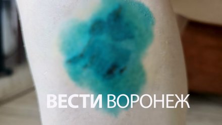 Агрессивная собака накинулась на девушку и её овчарку в Воронеже