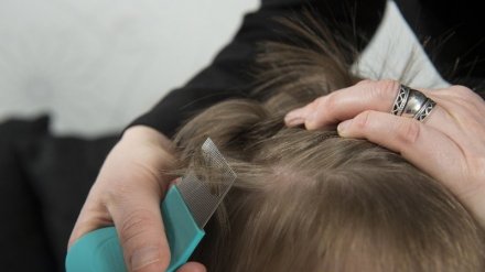 Родители учеников сообщили об атаке вшей в воронежской школе