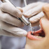 Воронежцам рассказали, как подготовиться к имплантации зуба