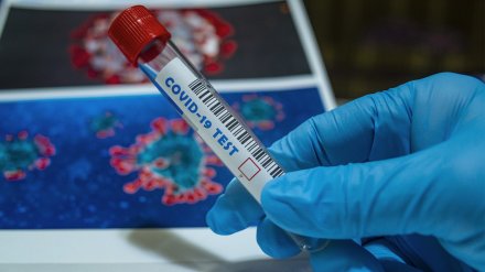 В Воронежской области COVID-19 нашли ещё у 105 человек