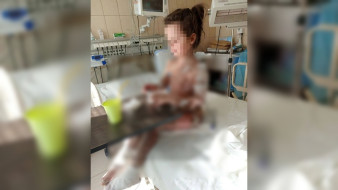 У 7-летней девочки отслоилась кожа после лечения в воронежской клинике