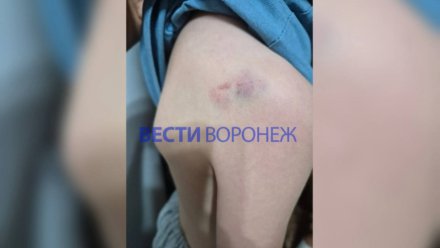 В Воронеже задержали ударившего трёх детей инвалида