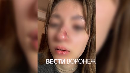 Избитую бывшим девушку в Воронеже обвинили в провокациях