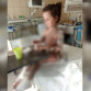 У 7-летней девочки отслоилась кожа после лечения в воронежской клинике
