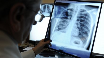В воронежских поликлиниках впервые внедрят искусственный интеллект