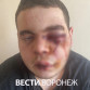 В Борисоглебске профессиональный боксёр избил парня до сотрясения мозга