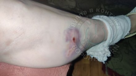 Бродячая собака напала на женщину на улице Машинистов в Воронеже