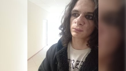 Избитый в центре Воронежа 17-летний американец покинул страну вместе с мамой