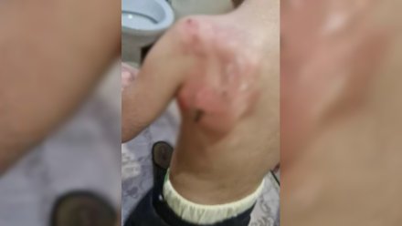 «Снимал кожу с майкой». Мама рассказала об издевательствах над сыном в павловском детсаду