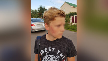 «От ударов упал на колени». Под Воронежем бывший полицейский избил 12-летнего мальчика