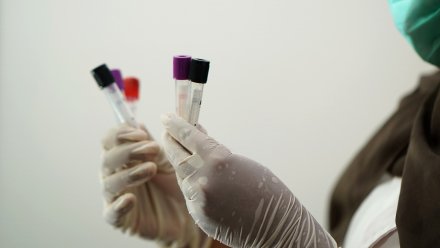 В Черноземье за сутки коронавирус нашли у 730 человек