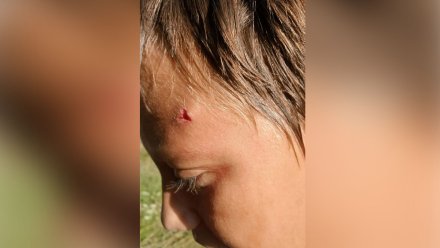 В воронежском райцентре подростку разбили голову из-за громкой музыки