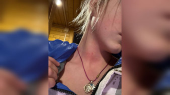 Собчак вмешалась в историю с «избиением» юной воронежской фигуристки