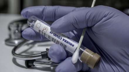 В Воронежской области за сутки COVID-19 выявили ещё у 44 человек