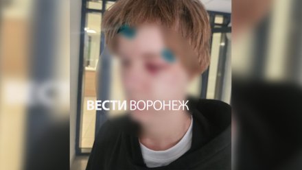 Дело об избиении подростка на проспекте Революции в Воронеже направили в суд