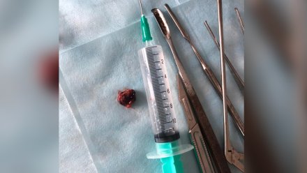 Воронежские врачи провели уникальную операцию и удалили опухоль из уха пенсионера
