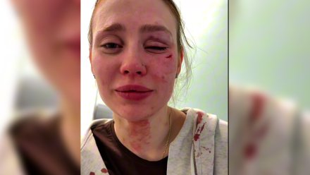 Полицейские установили личность напавшего на девушку у караоке-бара воронежца