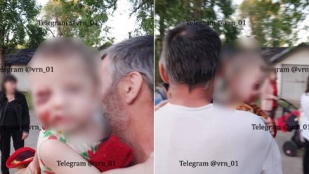 Медики рассказали о состоянии жестоко избитой в Воронеже годовалой малышки