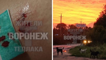 Стая собак напала на девушку в воронежском коттеджном посёлке